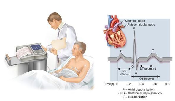 Electrocardiography to detect cardiovascular diseases in hypertension